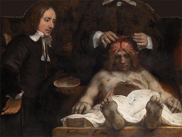 The Anatomy Lesson of Dr Joan Deyman, 1656 | Rembrandt | Giclée Canvas Print